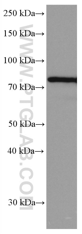 Western Blot (WB) analysis of HeLa cells using IRAK1 Monoclonal antibody (66653-1-Ig)