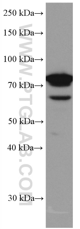 Western Blot (WB) analysis of HEK-293 cells using IRAK1 Monoclonal antibody (66653-1-Ig)