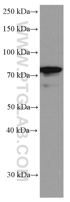 Western Blot (WB) analysis of MCF-7 cells using IRAK1 Monoclonal antibody (66653-1-Ig)