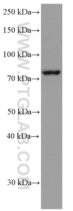 Western Blot (WB) analysis of Jurkat cells using IRAK1 Monoclonal antibody (66653-1-Ig)