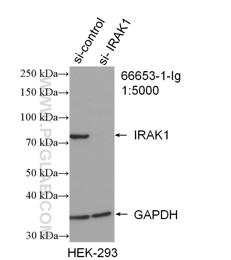 Western Blot (WB) analysis of HEK-293 cells using IRAK1 Monoclonal antibody (66653-1-Ig)