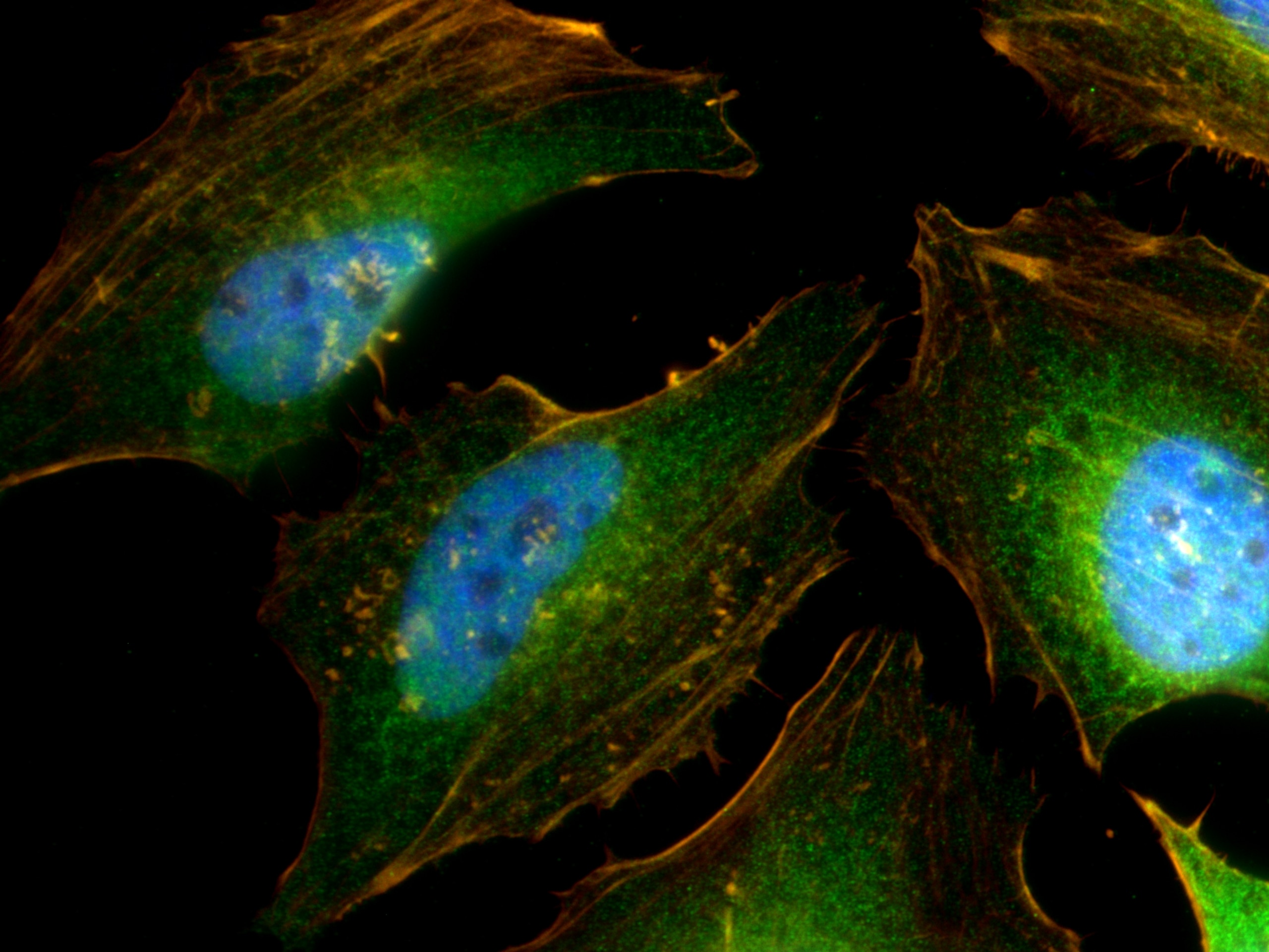 Immunofluorescence (IF) / fluorescent staining of HeLa cells using CoraLite® Plus 488-conjugated IRAK1 Polyclonal ant (CL488-10478)