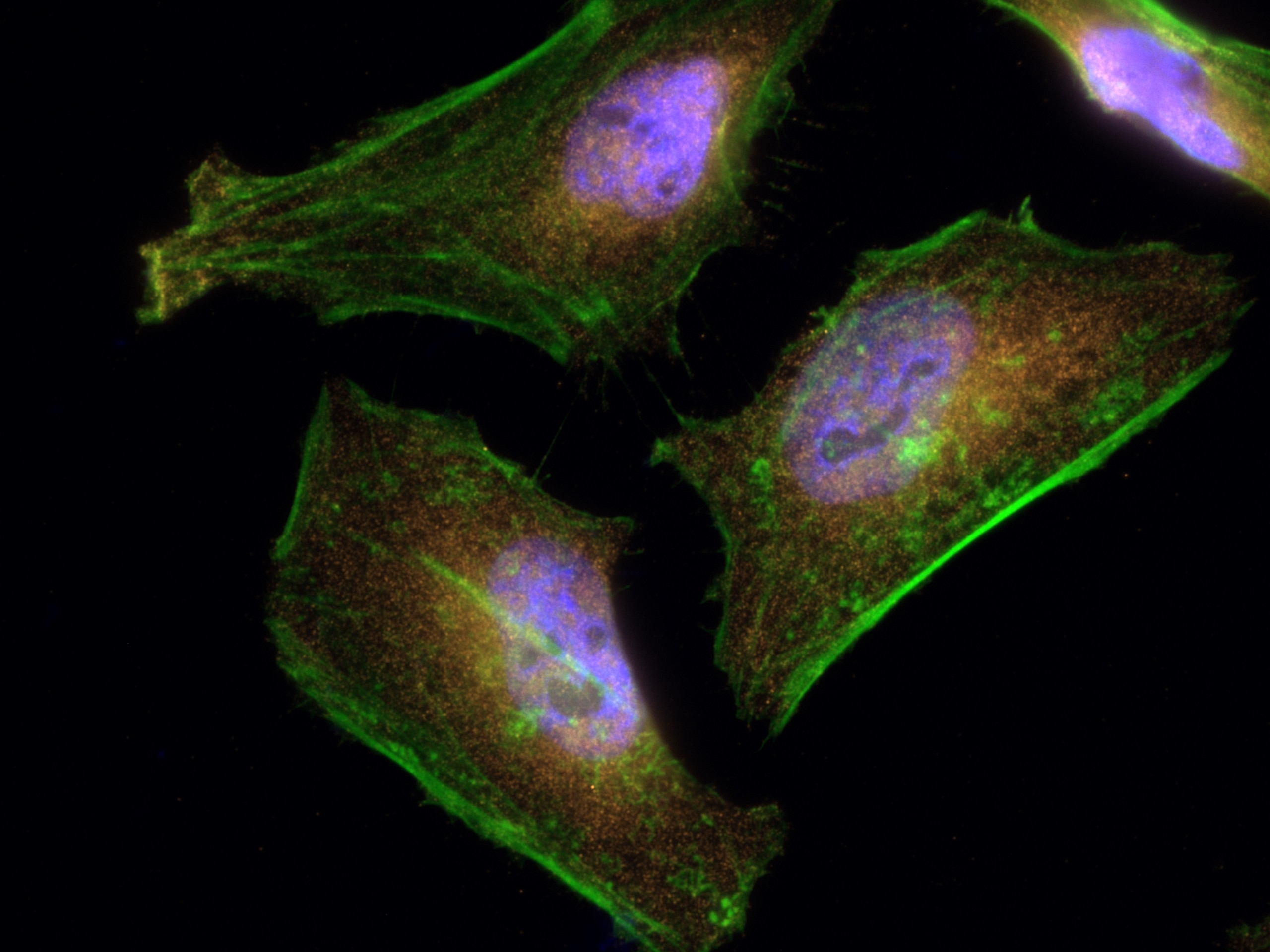 Immunofluorescence (IF) / fluorescent staining of HeLa cells using CoraLite®555-conjugated IRAK1 Polyclonal antibody (CL555-10478)