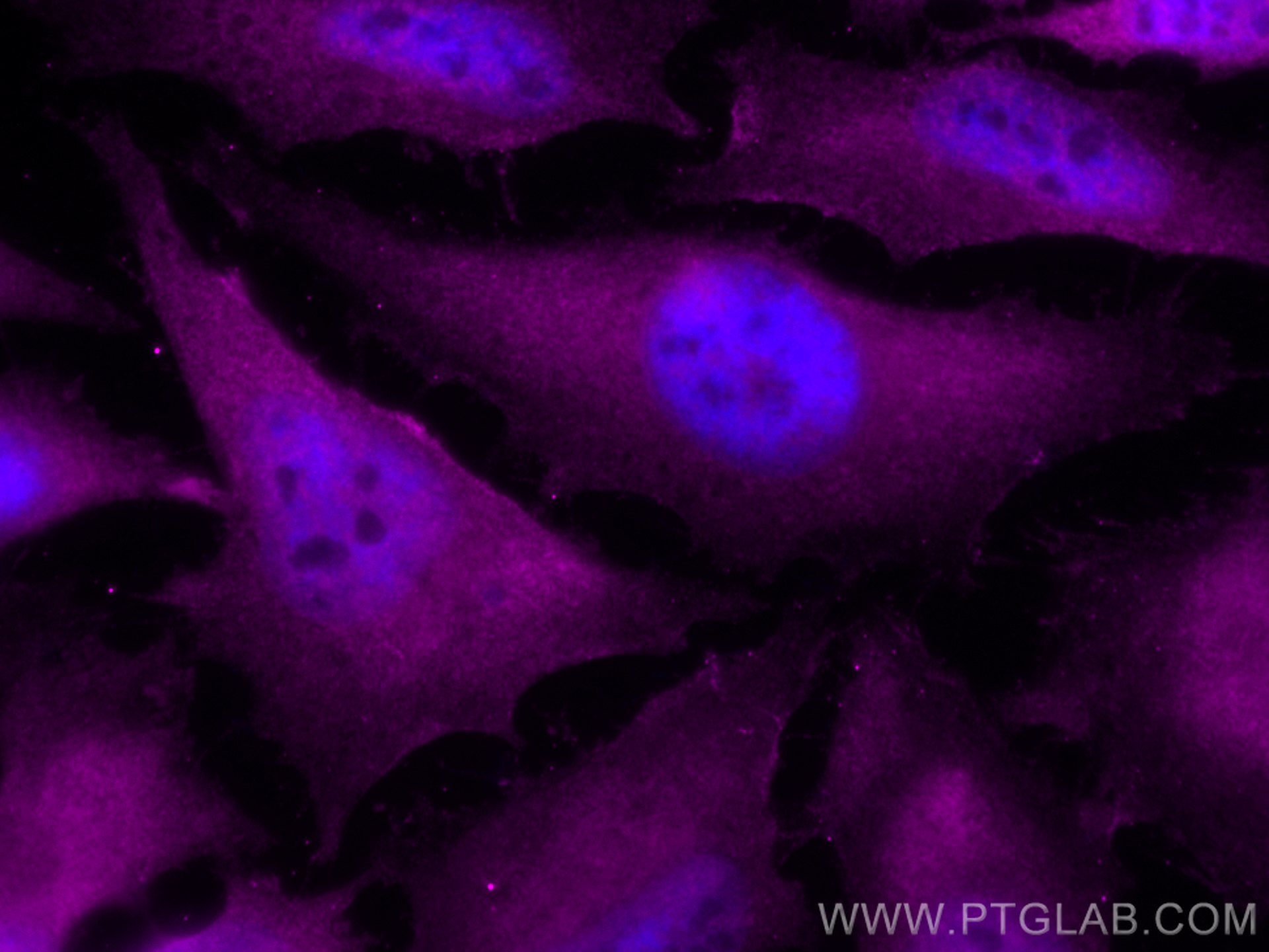 Immunofluorescence (IF) / fluorescent staining of HeLa cells using CoraLite® Plus 647-conjugated IRAK1 Polyclonal ant (CL647-10478)