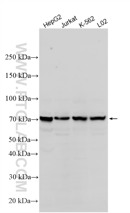 Western Blot (WB) analysis of various lysates using IRAK2 Polyclonal antibody (21700-1-AP)
