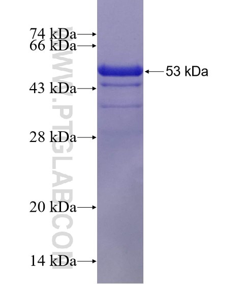 IRAK2 fusion protein Ag28179 SDS-PAGE