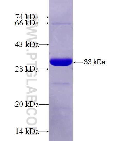 IRAK2 fusion protein Ag28191 SDS-PAGE