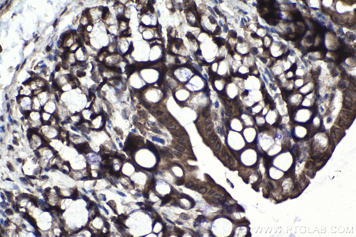 Immunohistochemistry (IHC) staining of mouse colon tissue using IRAK3 Polyclonal antibody (28766-1-AP)