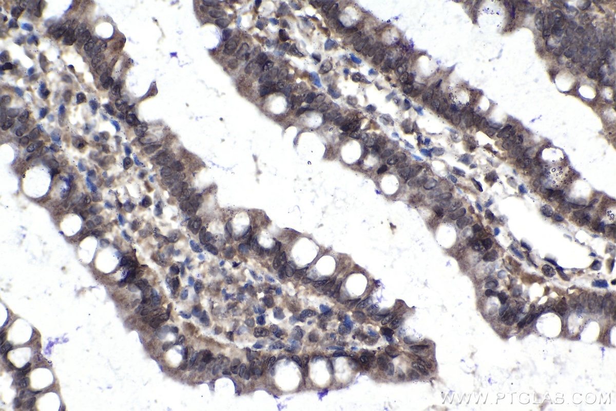Immunohistochemistry (IHC) staining of rat small intestine tissue using IRAK3 Polyclonal antibody (28766-1-AP)