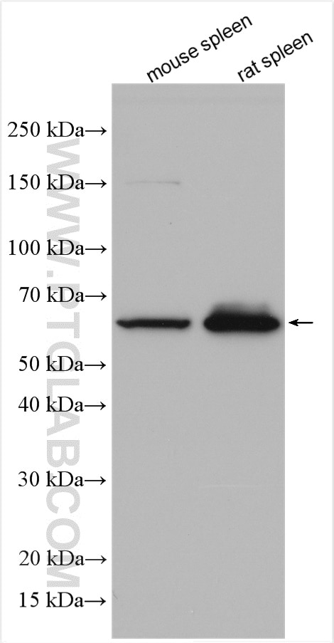 Western Blot (WB) analysis of various lysates using IRAK3 Polyclonal antibody (28766-1-AP)