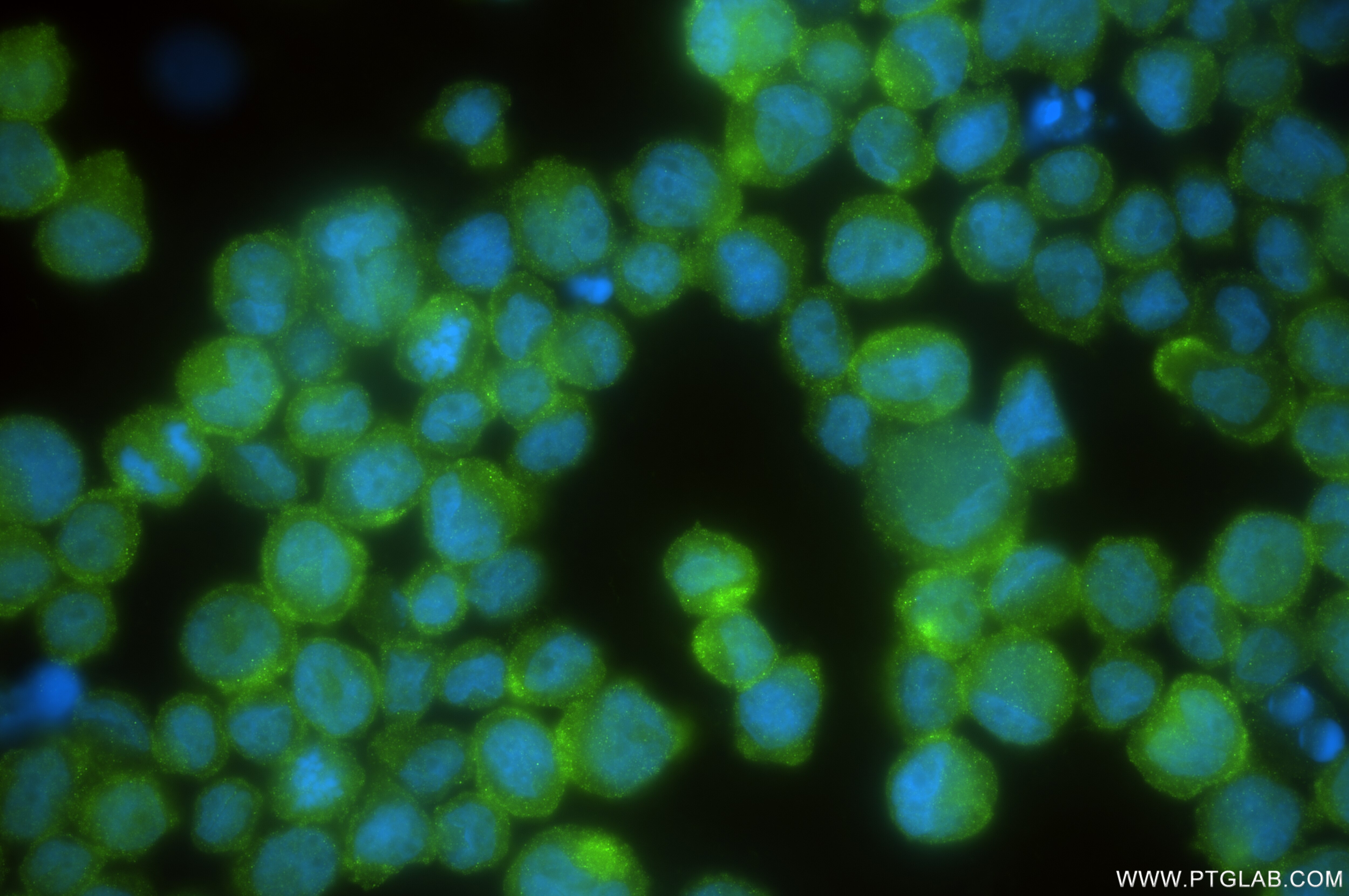 Immunofluorescence (IF) / fluorescent staining of THP-1 cells using IRAK3 Recombinant antibody (83876-2-RR)