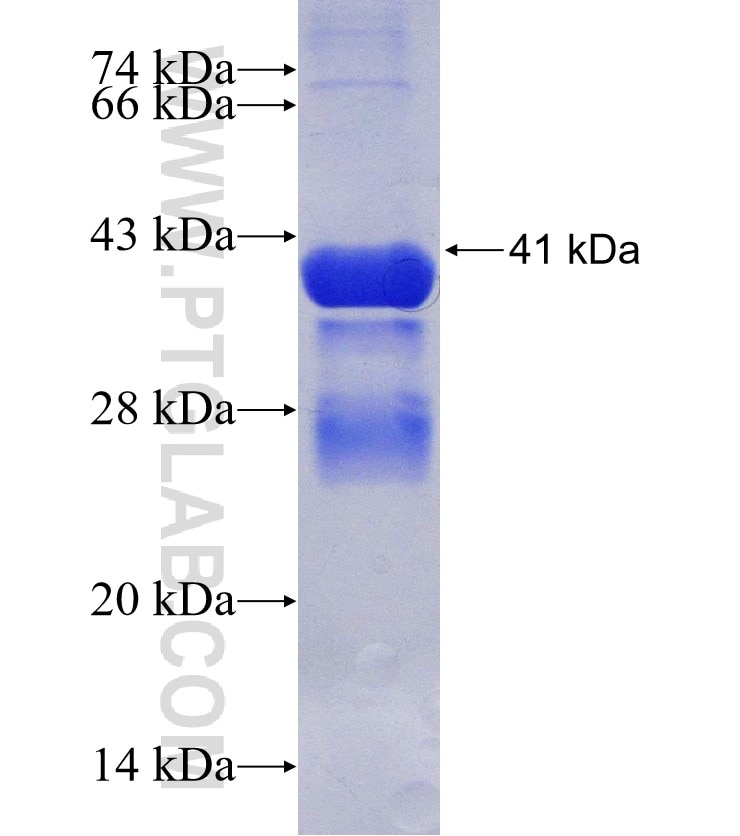IRAK3 fusion protein Ag30309 SDS-PAGE