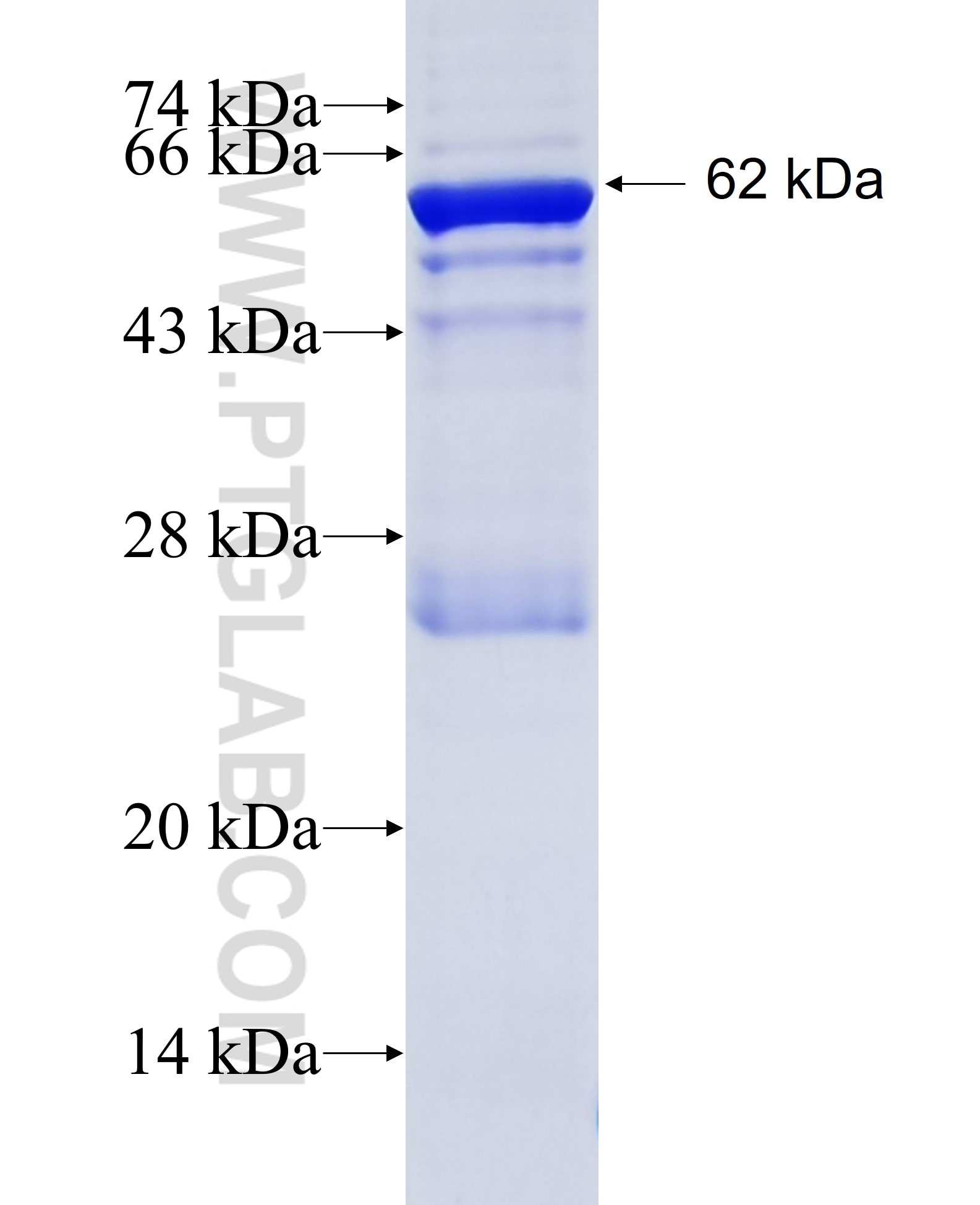 IRAK3 fusion protein Ag4959 SDS-PAGE