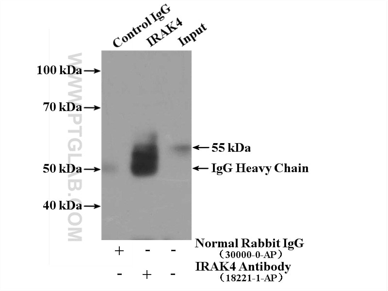 Immunoprecipitation (IP) experiment of K-562 cells using IRAK4 Polyclonal antibody (18221-1-AP)