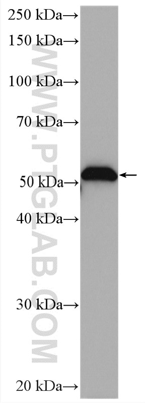 Western Blot (WB) analysis of Jurkat cells using IRAK4 Polyclonal antibody (18221-1-AP)