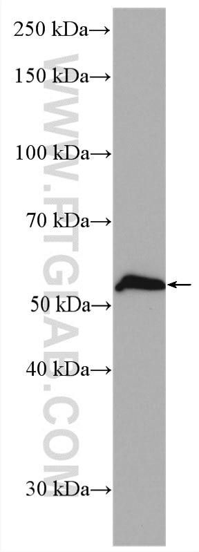 Western Blot (WB) analysis of Jurkat cells using IRAK4 Polyclonal antibody (18221-1-AP)