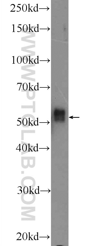 IRAK4 Polyclonal antibody