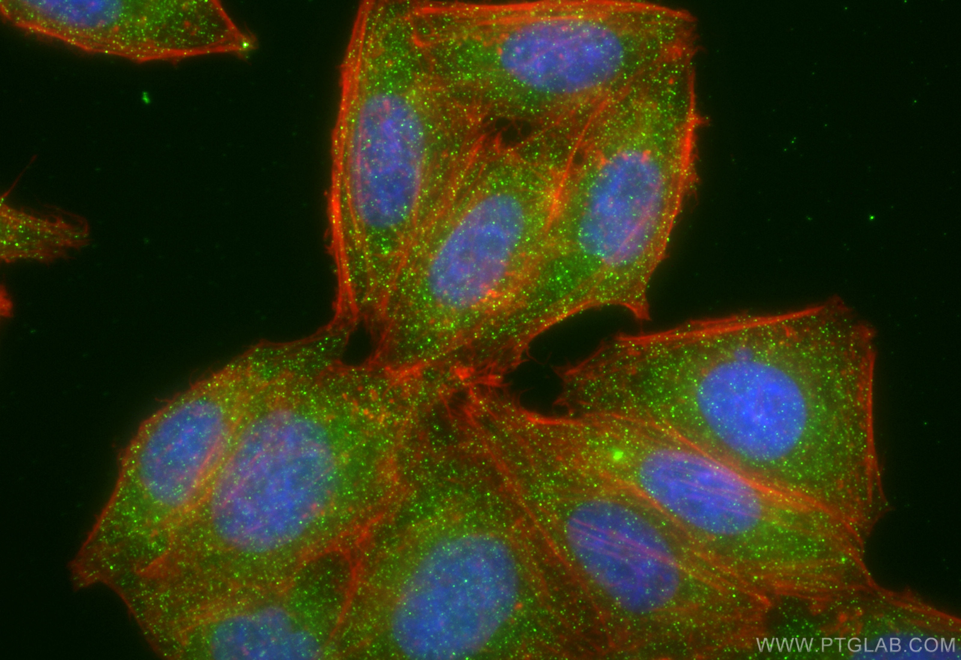 Immunofluorescence (IF) / fluorescent staining of HepG2 cells using IRAK4 Monoclonal antibody (67180-1-Ig)