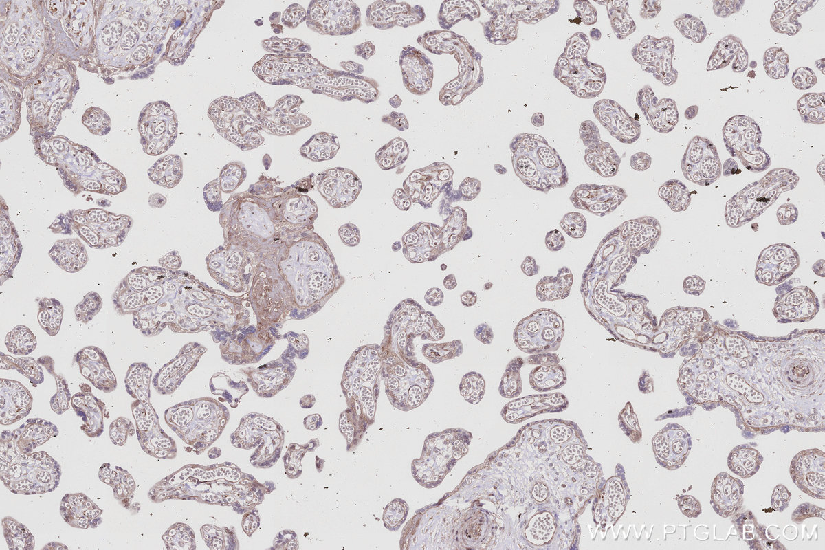 Immunohistochemistry (IHC) staining of human placenta tissue using IRAK4 Monoclonal antibody (67180-1-Ig)