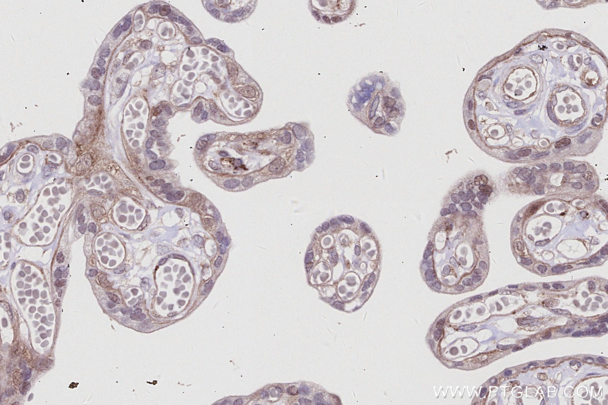 Immunohistochemistry (IHC) staining of human placenta tissue using IRAK4 Monoclonal antibody (67180-1-Ig)
