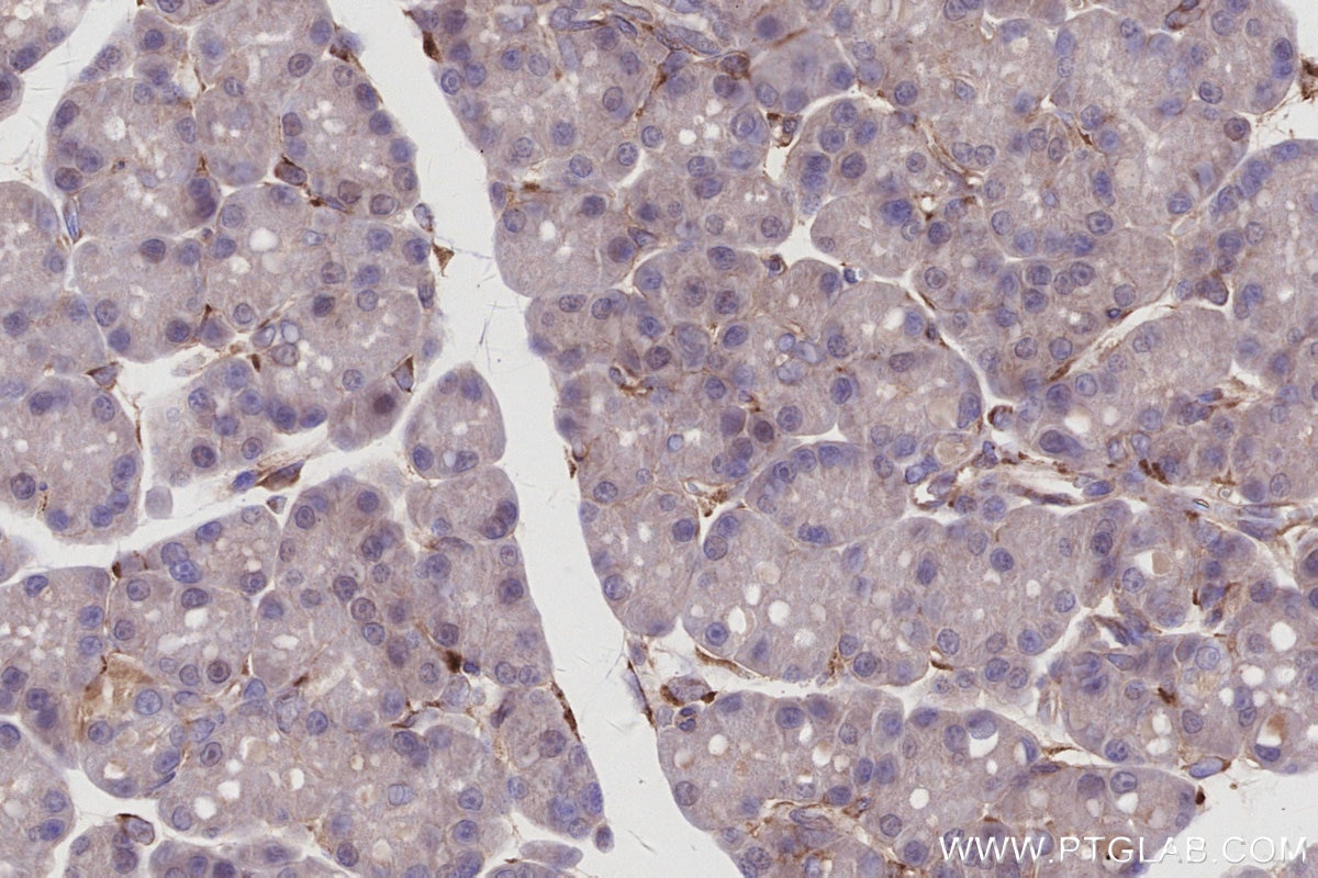 Immunohistochemistry (IHC) staining of rat pancreas tissue using IRAK4 Monoclonal antibody (67180-1-Ig)