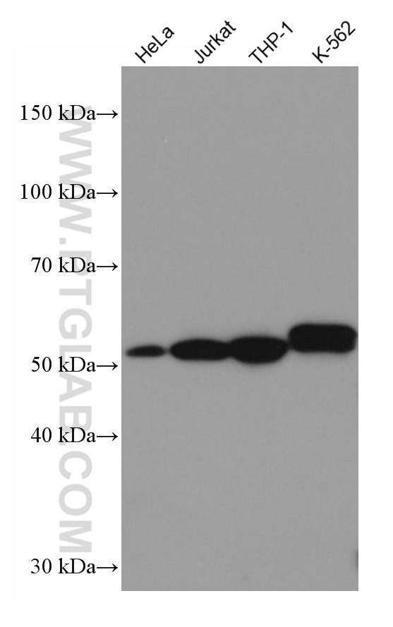 WB analysis using 67180-1-Ig