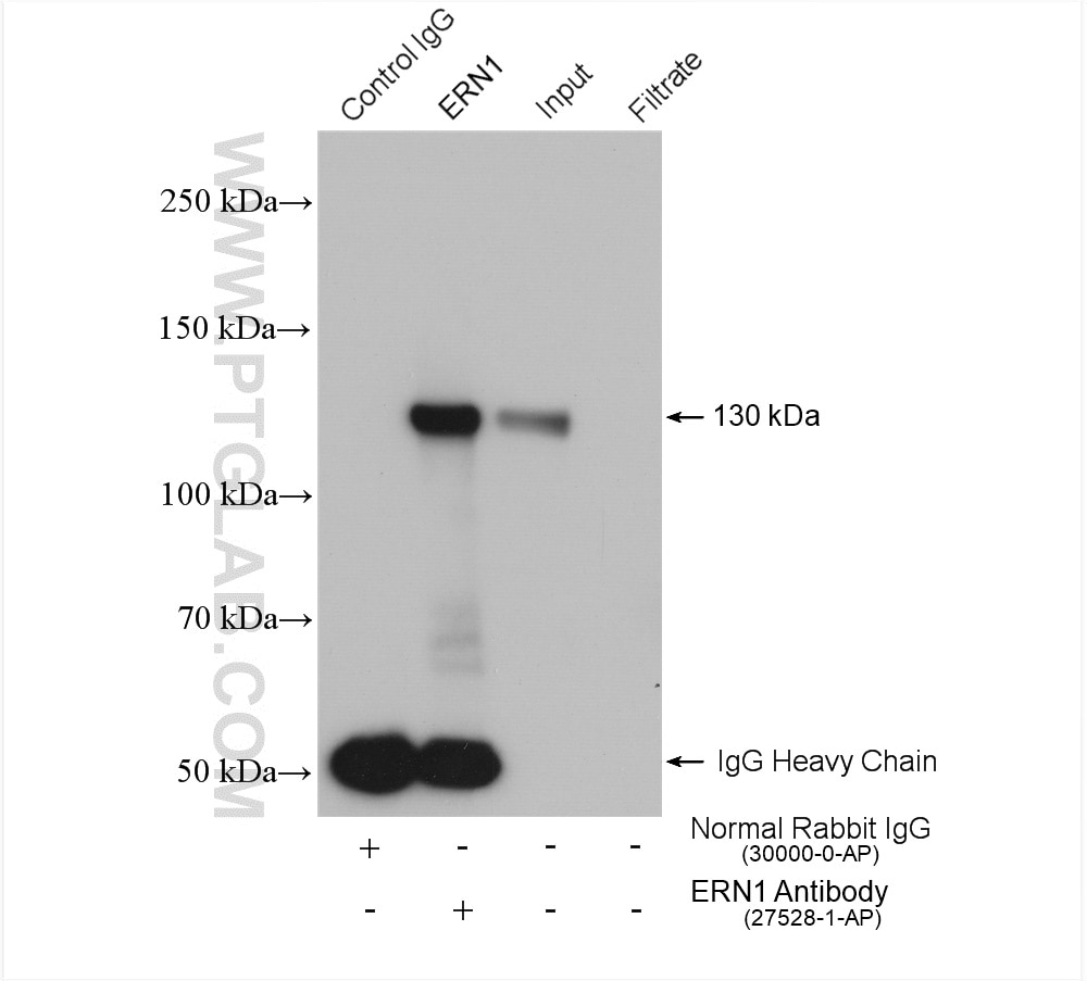 Immunoprecipitation (IP) experiment of A549 cells using IRE1; ERN1 Polyclonal antibody (27528-1-AP)