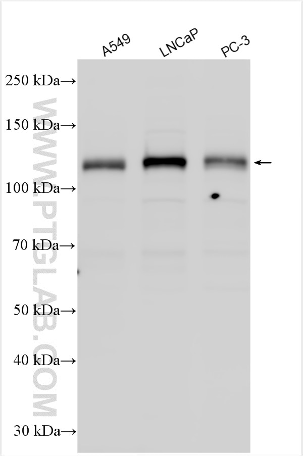 Western Blot (WB) analysis of various lysates using IRE1; ERN1 Polyclonal antibody (27528-1-AP)