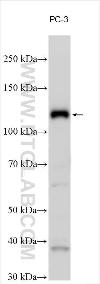 Western Blot (WB) analysis of various lysates using IRE1; ERN1 Polyclonal antibody (28164-1-AP)