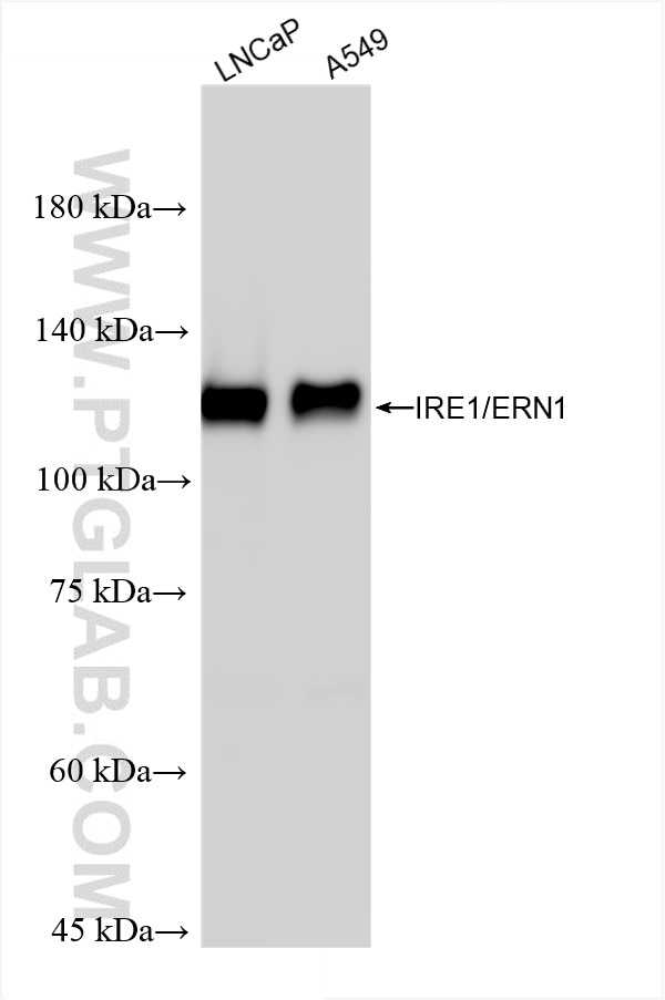 Various lysates were subjected to SDS PAGE followed by western blot with 82687-5-RR (IRE1; ERN1 antibody) at dilution of 1:5000 incubated at room temperature for 1.5 hours. Western Blot (WB) analysis of various lysates using IRE1/ERN1 Recombinant antibody (82687-5-RR)