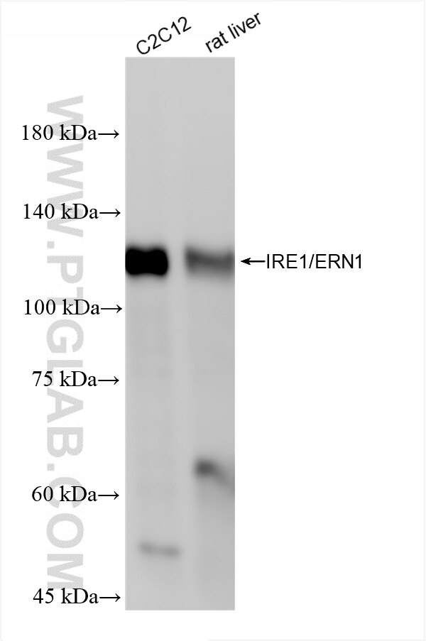 Various lysates were subjected to SDS PAGE followed by western blot with 82687-5-RR (IRE1; ERN1 antibody) at dilution of 1:5000 incubated at room temperature for 1.5 hours. Western Blot (WB) analysis of various lysates using IRE1/ERN1 Recombinant antibody (82687-5-RR)