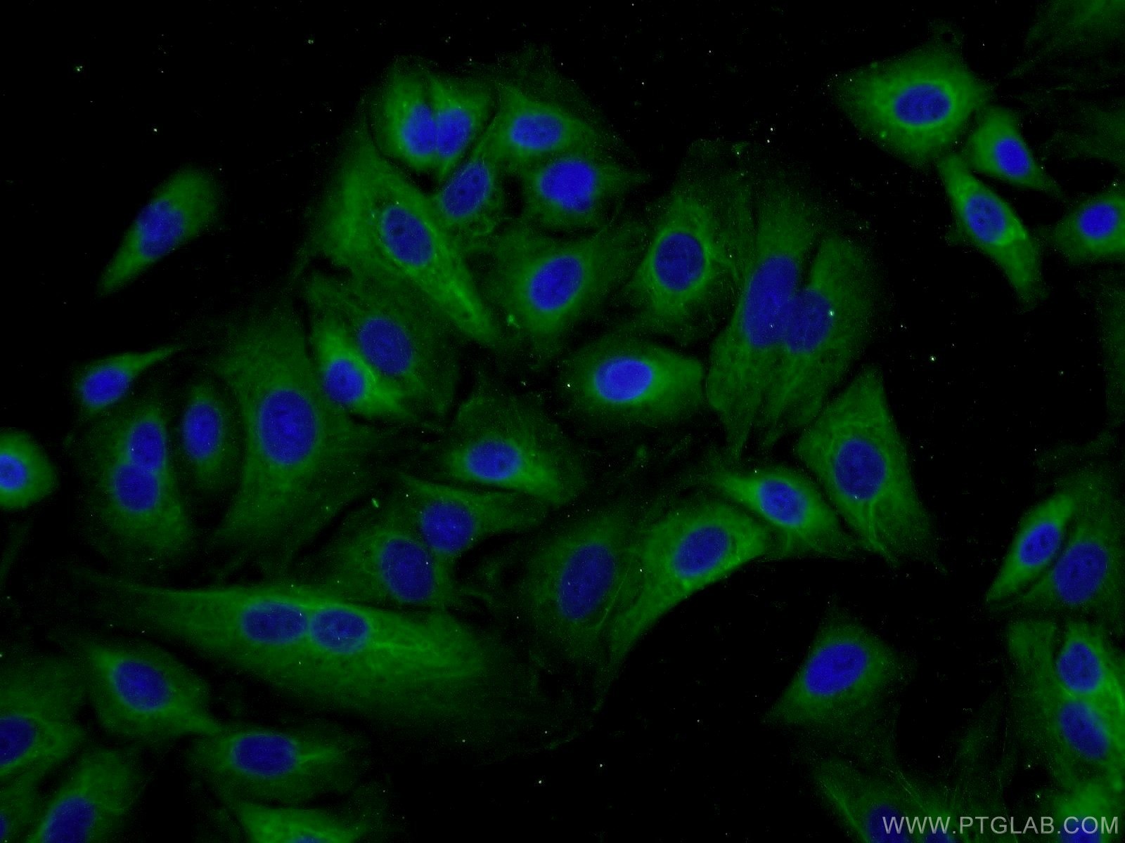 Immunofluorescence (IF) / fluorescent staining of A549 cells using IREB2 Polyclonal antibody (23829-1-AP)