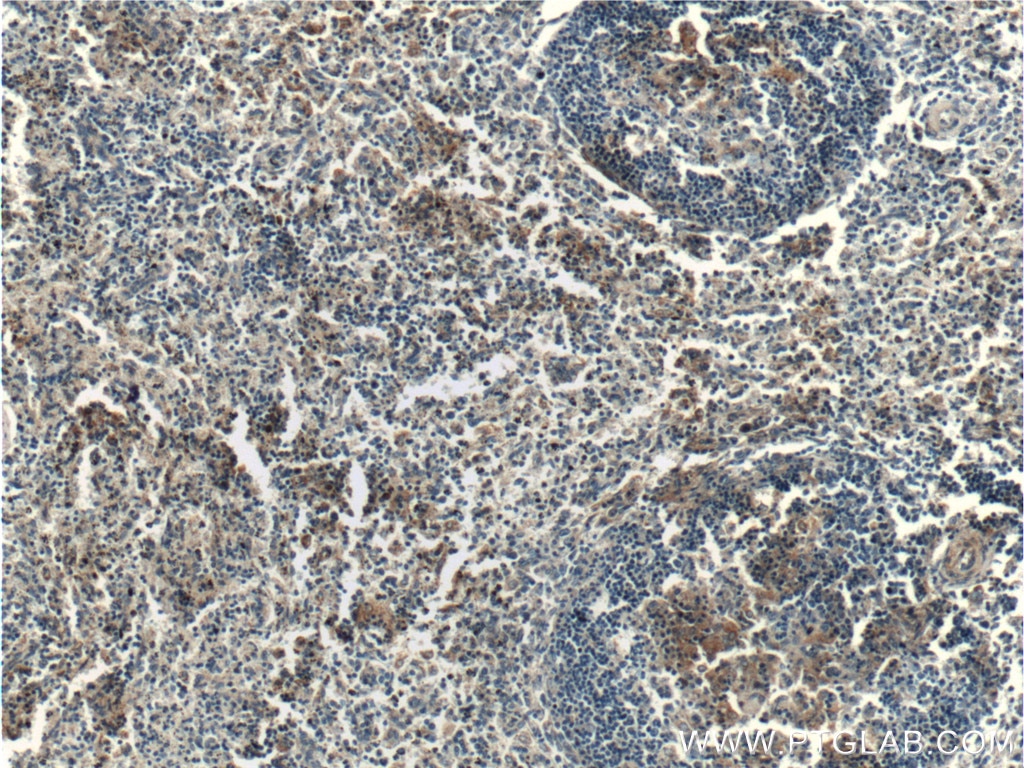 Immunohistochemistry (IHC) staining of human spleen tissue using IREB2 Polyclonal antibody (23829-1-AP)