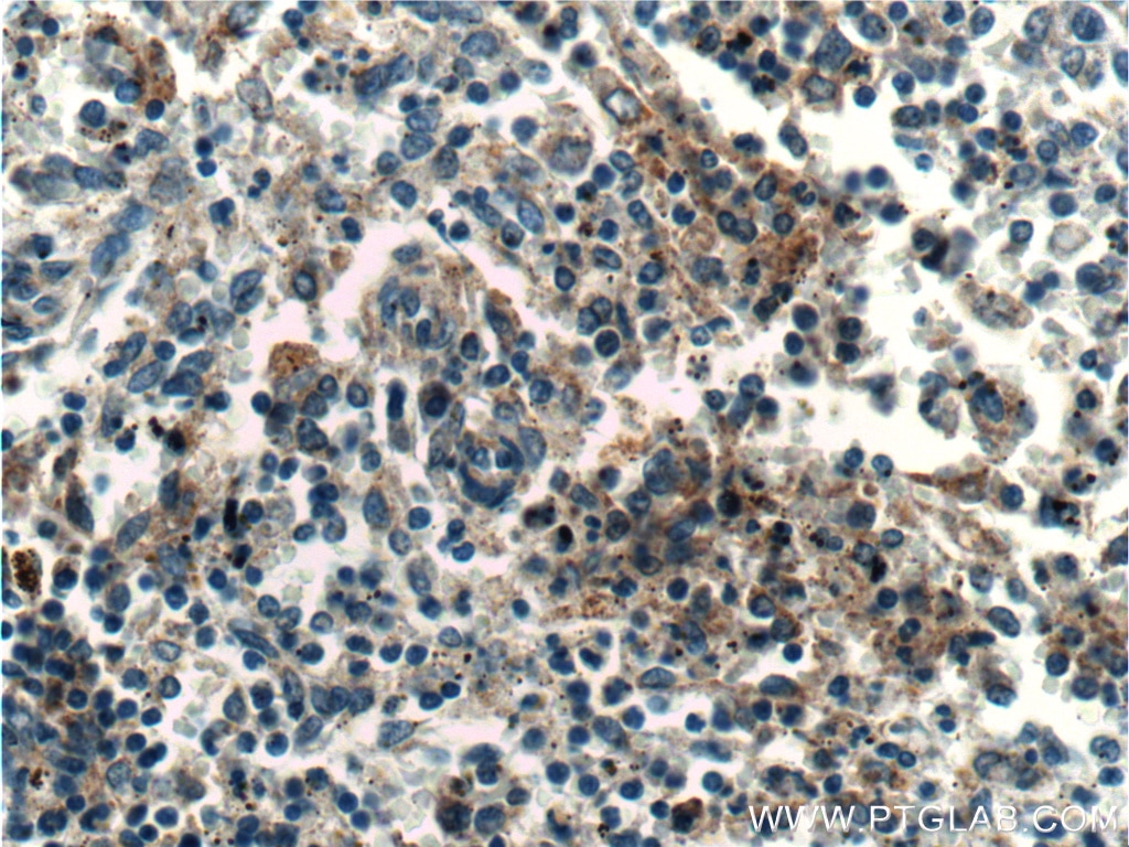 Immunohistochemistry (IHC) staining of human spleen tissue using IREB2 Polyclonal antibody (23829-1-AP)