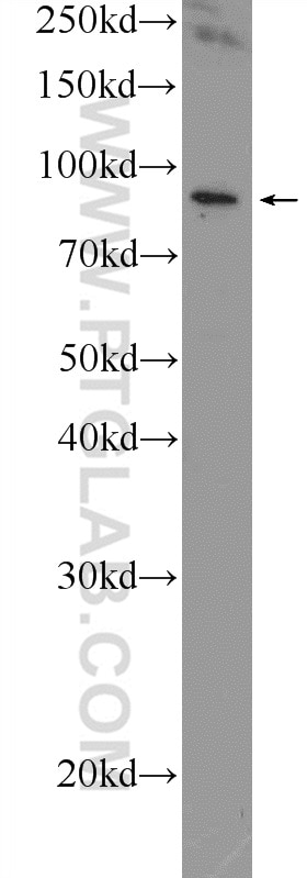 WB analysis of PC-13 using 23829-1-AP