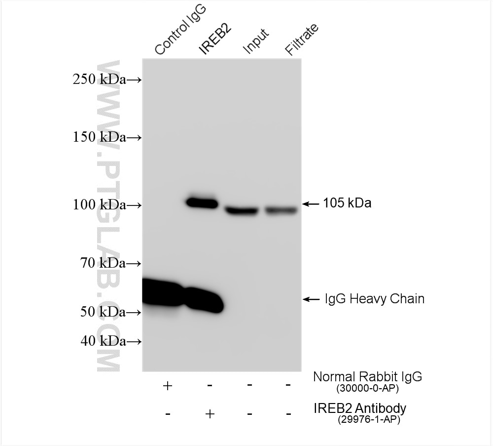 Immunoprecipitation (IP) experiment of mouse liver tissue using IREB2 Polyclonal antibody (29976-1-AP)