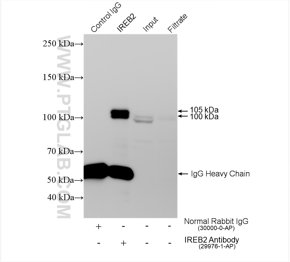 Immunoprecipitation (IP) experiment of A549 cells using IREB2 Polyclonal antibody (29976-1-AP)