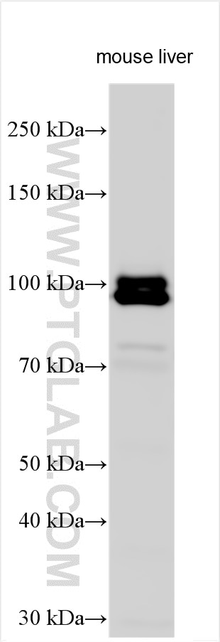 Western Blot (WB) analysis of various lysates using IREB2 Polyclonal antibody (29976-1-AP)