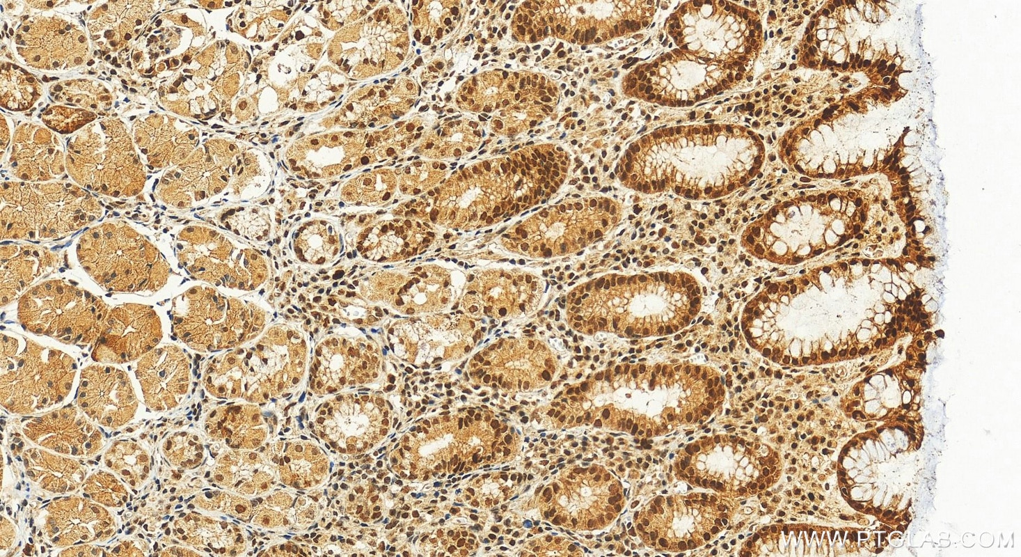 Immunohistochemistry (IHC) staining of human stomach tissue using IRF1 Polyclonal antibody (11335-1-AP)