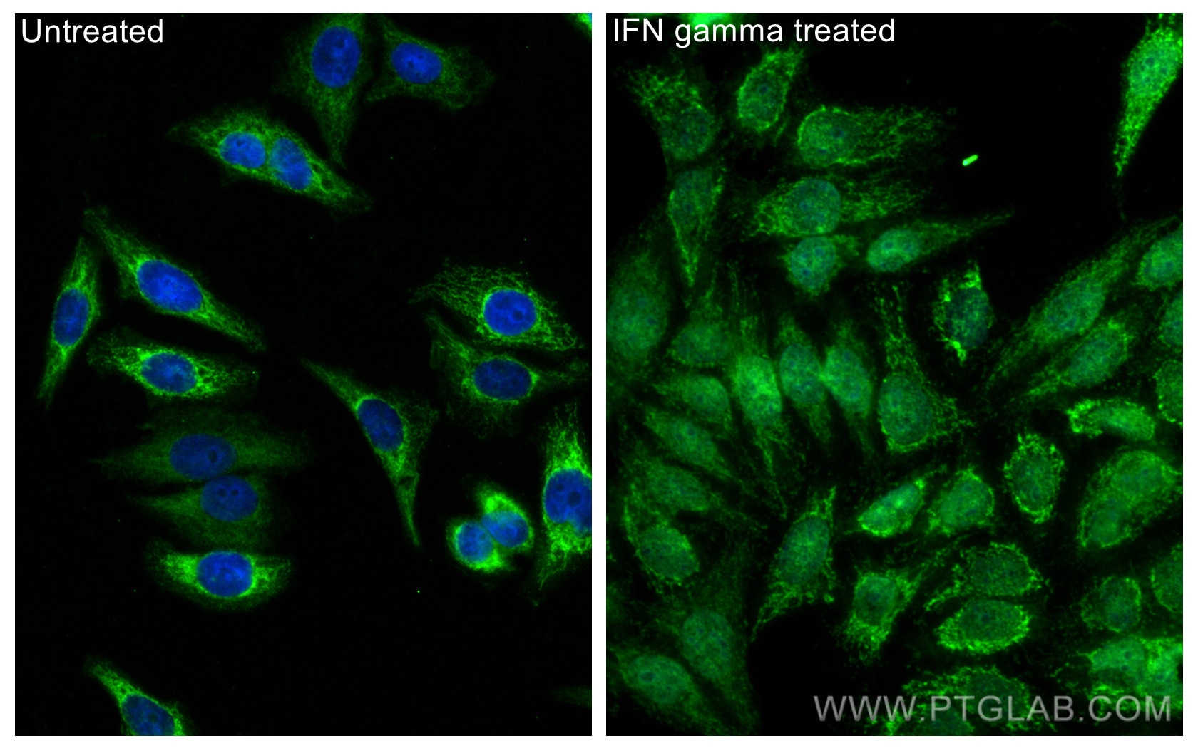 Immunofluorescence (IF) / fluorescent staining of HepG2 cells using IRF1 Polyclonal antibody (11335-1-AP)