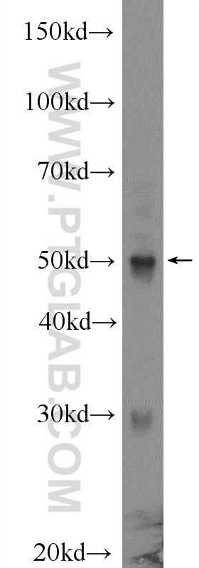 Western Blot (WB) analysis of Jurkat cells using IRF1 Polyclonal antibody (11335-1-AP)