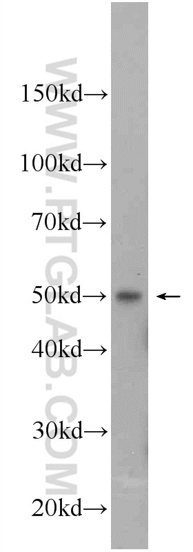 Western Blot (WB) analysis of Jurkat cells using IRF1 Polyclonal antibody (11335-1-AP)