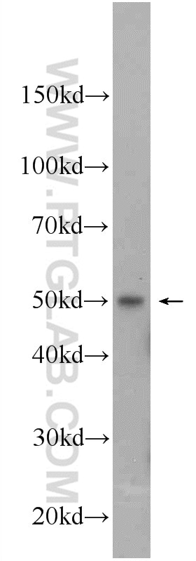 Western Blot (WB) analysis of Jurkat cells using IRF1 Polyclonal antibody (11335-1-AP)