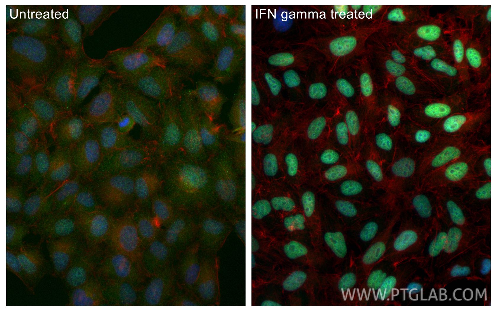 Immunofluorescent analysis of (4% PFA) fixed IFN gamma treated HepG2 cells using IRF1 antibody (85254-3-RR, Clone: 250167D11 ) at dilution of 1:400 and CoraLite®488-Conjugated Goat Anti-Rabbit IgG(H+L) (SA00013-2), CL594-phalloidin (red). Immunofluorescence (IF) / fluorescent staining of HepG2 cells using IRF1 Recombinant monoclonal antibody (85254-3-RR)