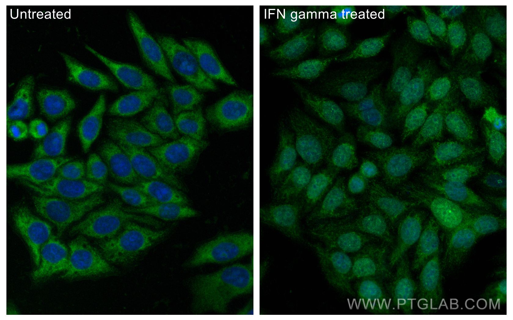 Immunofluorescence (IF) / fluorescent staining of HepG2 cells using CoraLite® Plus 488-conjugated IRF1 Polyclonal anti (CL488-11335)