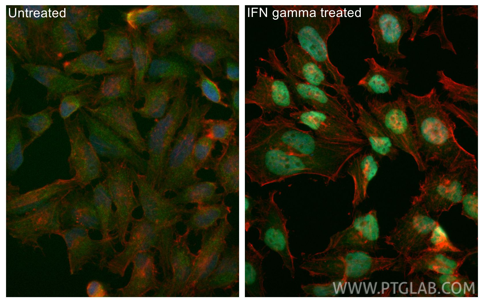 IF Staining of HeLa using CL488-85254-3 Immunofluorescence (IF) / fluorescent staining of HeLa cells using CoraLite® Plus 488-conjugated IRF1 Recombinant mon (CL488-85254-3)