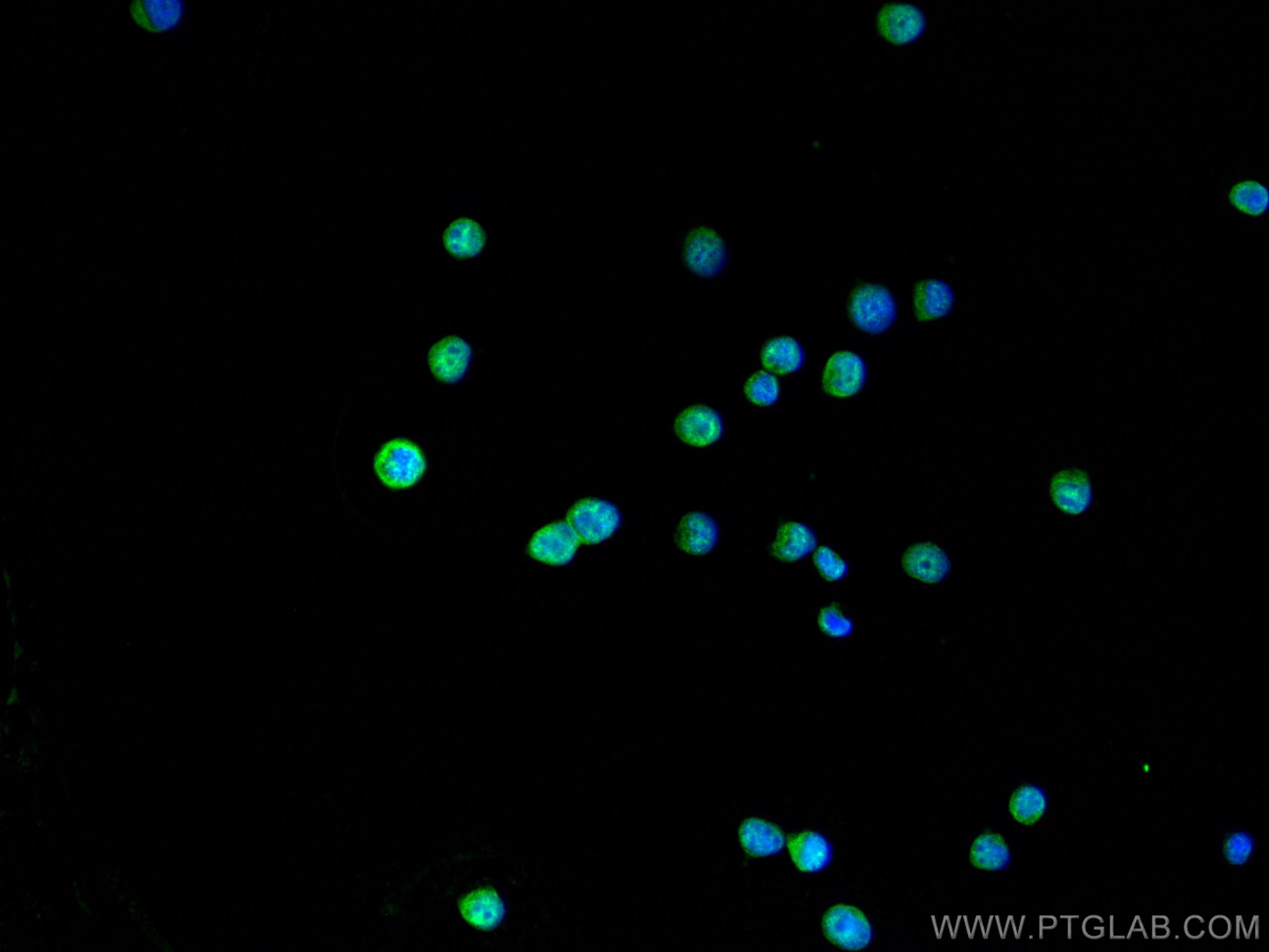 Immunofluorescence (IF) / fluorescent staining of Jurkat cells using IRF2 Polyclonal antibody (12525-1-AP)