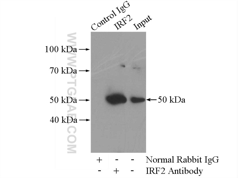 Immunoprecipitation (IP) experiment of Jurkat cells using IRF2 Polyclonal antibody (12525-1-AP)