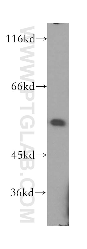 Western Blot (WB) analysis of Jurkat cells using IRF2 Polyclonal antibody (12525-1-AP)