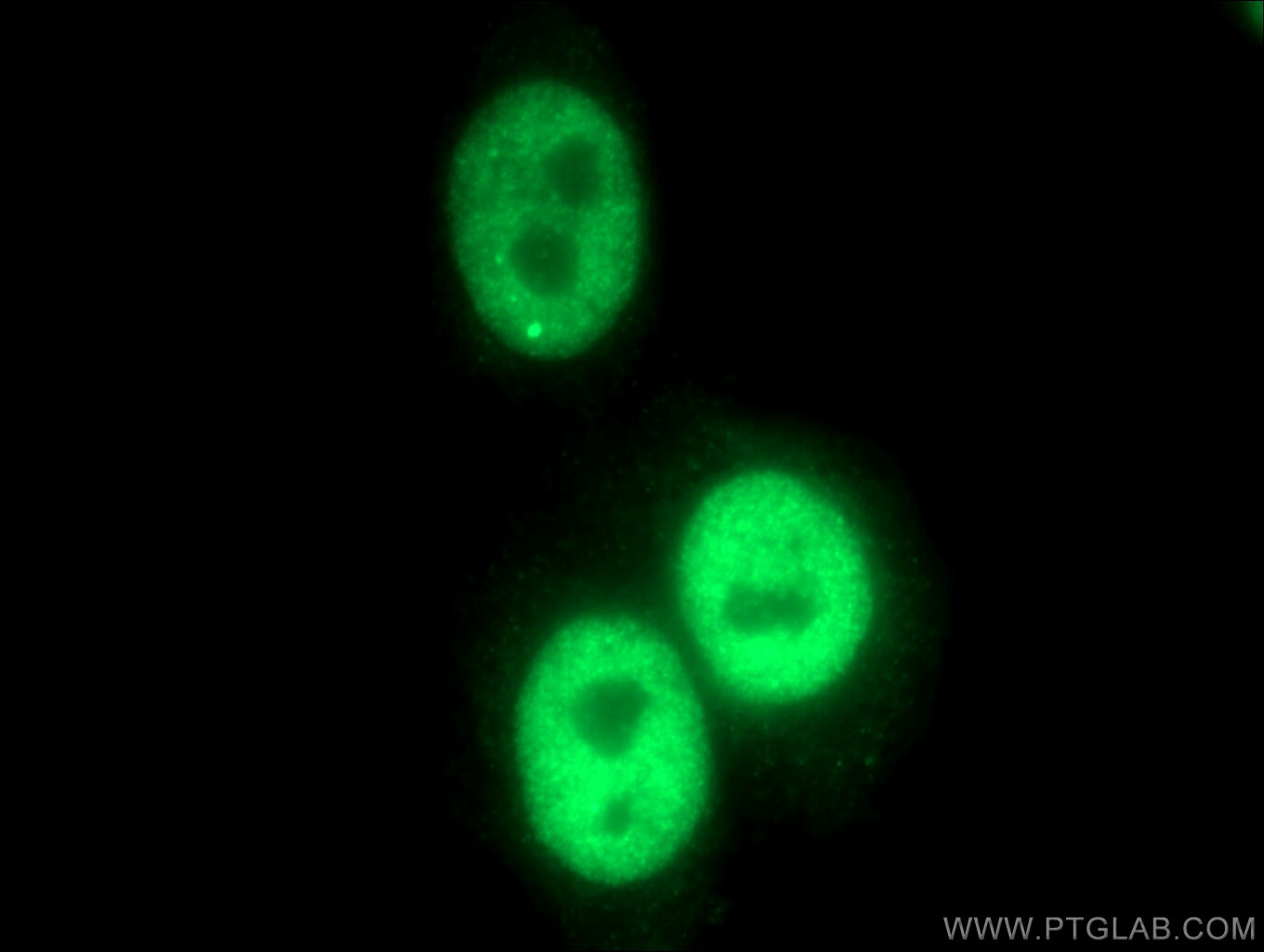 Immunofluorescence (IF) / fluorescent staining of HeLa cells using IRF2BP1 Polyclonal antibody (13698-1-AP)